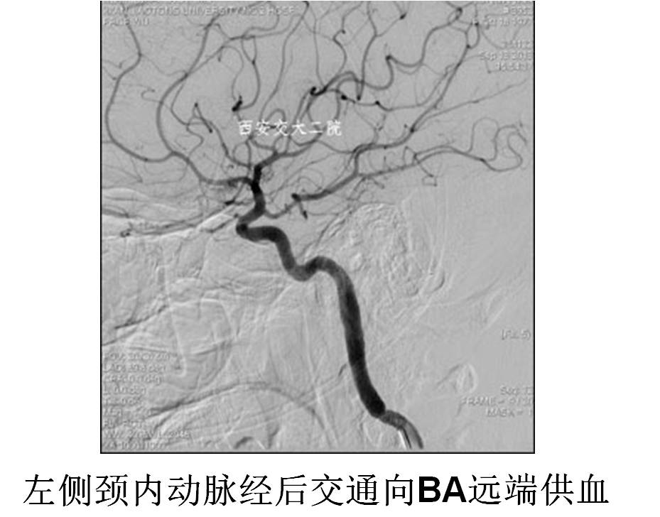 介入科病例,介入手术的健康科普方案