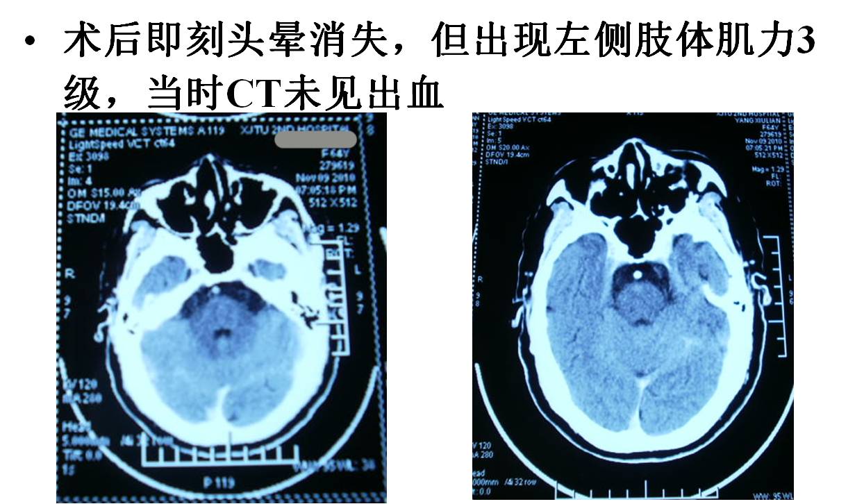 介入科病例,介入手术的健康科普方案
