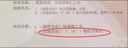 hpv检测16和66是阳性传染吗,hpv检测pccc阳性是什么意思