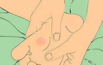 打羽毛球后脚跟起茧子怎么办,打羽毛球脚底水泡破了多久能好