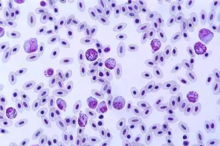 如果小鸟受伤了该怎么救助,发现受伤的小鸟应该怎么办