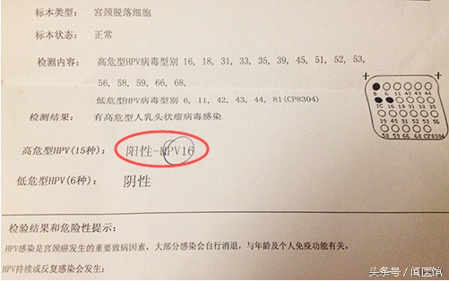 hpv检测16和66是阳性传染吗,hpv检测pccc阳性是什么意思