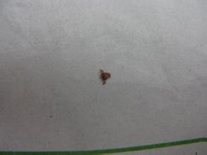 得了阴虱病治疗几天可以治愈,阴虱啥病