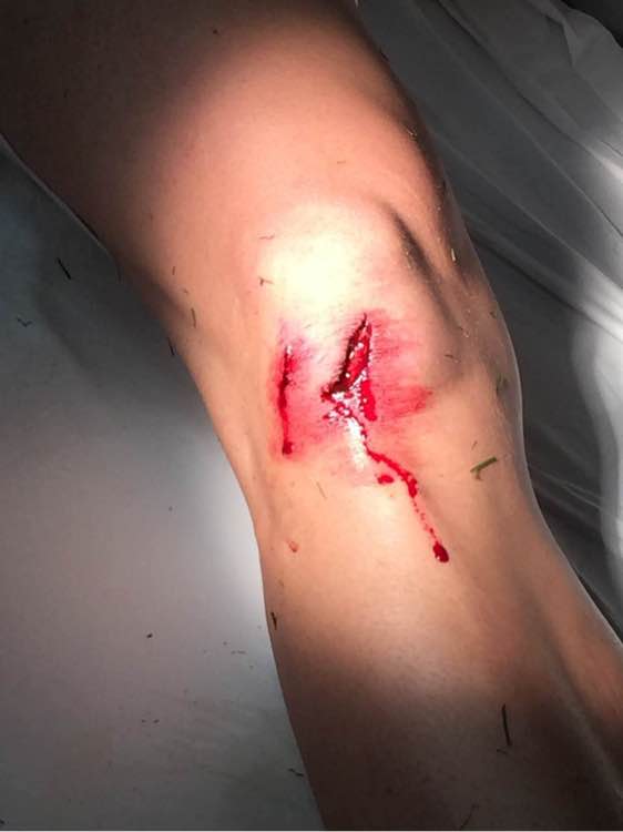 他是锋线杀手！一年废4人，爆头队友！球迷：有他中超能好？