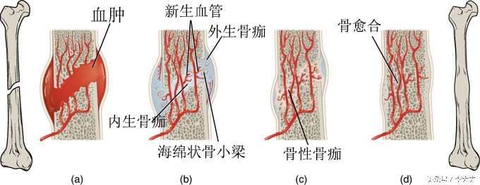 脑洞大开找出活下去的办法,断的骨头是怎样长回来的
