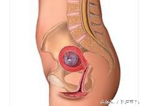 痛经不易孕有科学依据吗,女人痛经不容易受孕么
