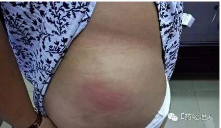 震惊孕妇谨慎！海南再现百例黄体酮不良事件