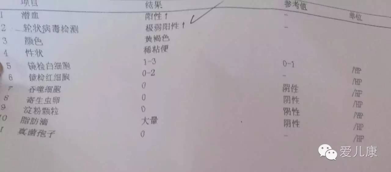 医生推荐儿童增高药,孩子个子矮能吃增高药吗