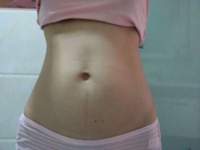 流产之后肚子为什么变大了,流产后小肚子变大了怎么回事