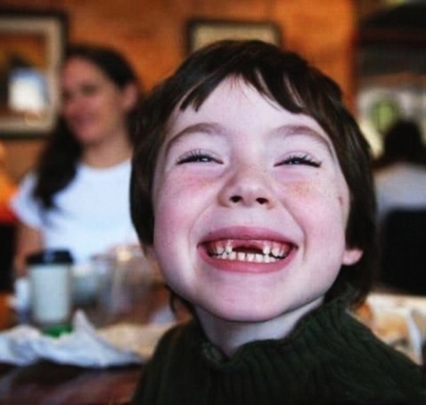 哪种镶牙材料价格又便宜又好,镶牙哪种材料最好