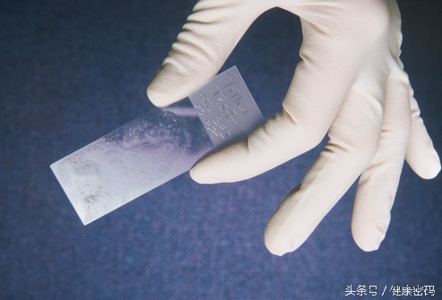 子宫检查报告单如何看,妇科子宫颈刮片是怎么检查的