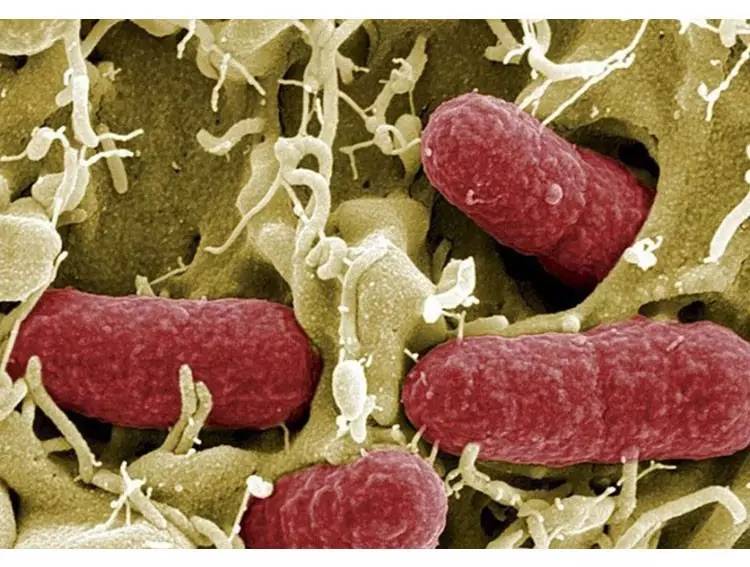 夏季如何预防幼儿肠道疾病,夏季宝宝们要关注预防哪些疾病