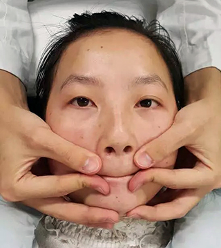 偏瘫嘴部歪训练,歪嘴改善动作