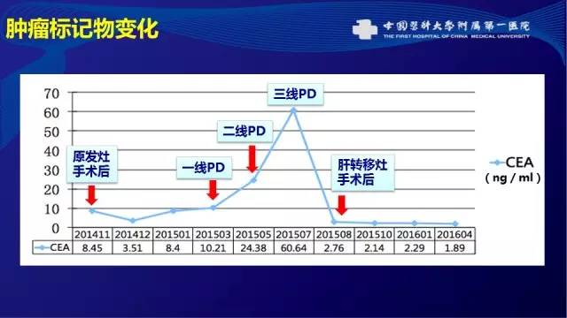 肠癌肝转移同时性和异时性,邢宝才治疗肠癌肝转移成功病例