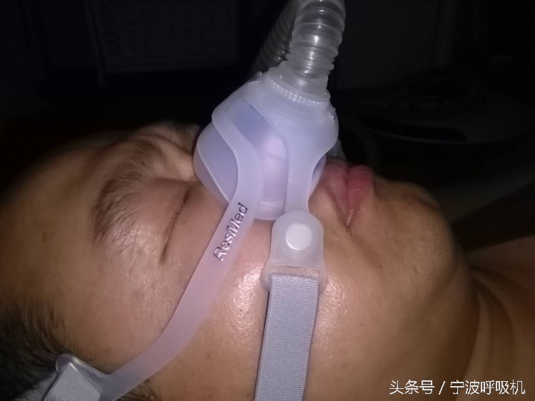 瑞思迈呼吸机s10面罩怎么选,瑞思迈呼吸机n20鼻罩怎么戴才舒服