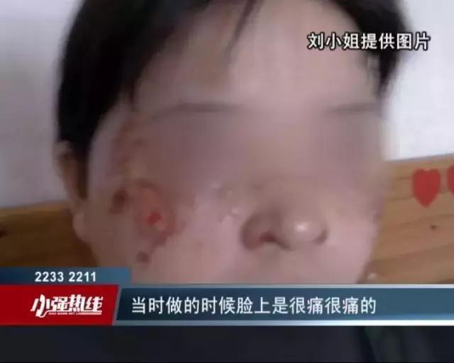 药水祛斑毁容能恢复吗,药水祛斑的后遗症