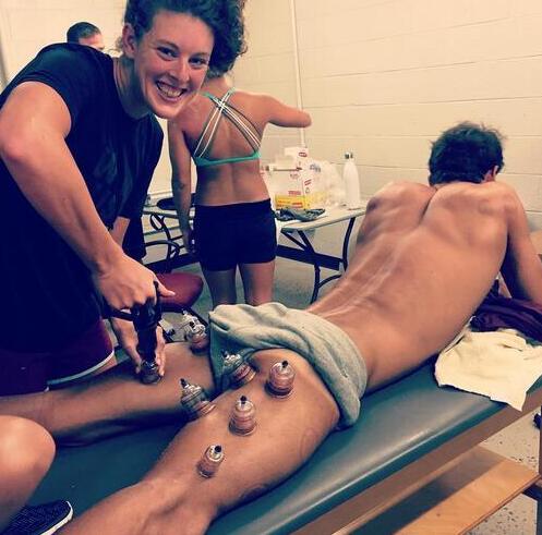 中国魔法拔火罐,北京奥运村拔火罐