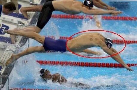 中国魔法拔火罐,北京奥运村拔火罐