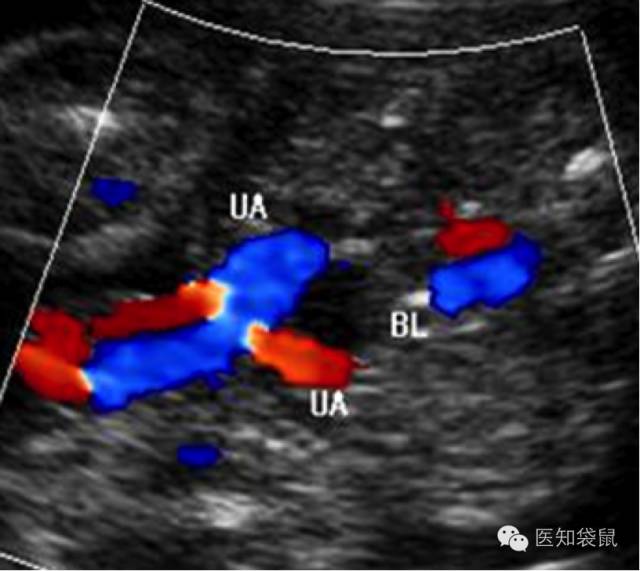 深度解析：普通B超、三维及四维彩超的区别