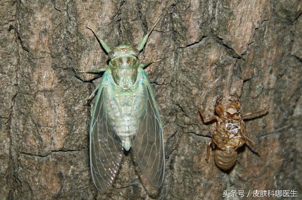 荨麻疹草药治疗法,中药治荨麻疹的最好方法