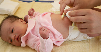 怎样预防新生儿脐炎,新生儿脐炎预防护理新进展