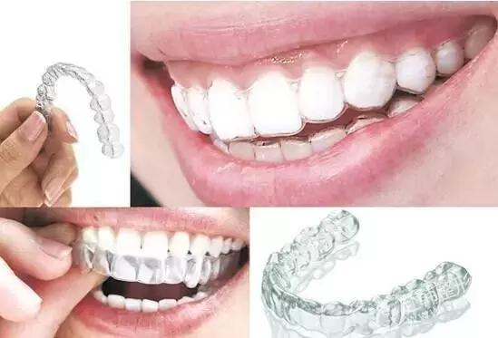 鐗欏尰helen涓撴爮绉戞櫘,helen鐗欑