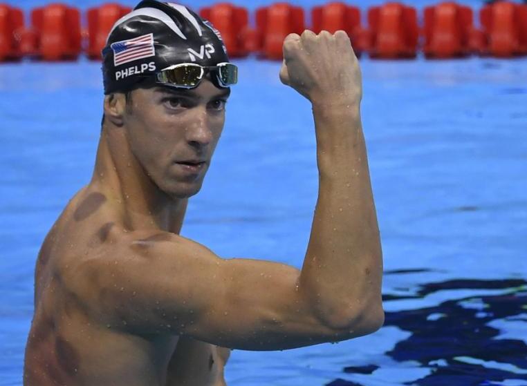 中国魔法拔火罐,北京奥运村拔火罐