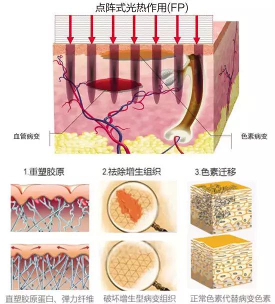 吴敏霞带伤训练视频,吴敏霞年轻的时候长啥样