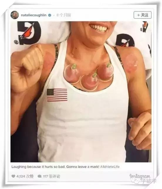 里约奥运会开幕式点燃火炬,里约奥运会拔火罐