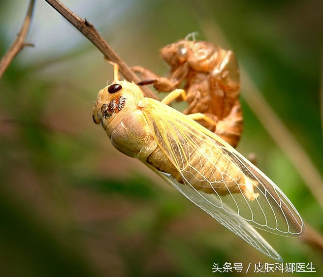 荨麻疹草药治疗法,中药治荨麻疹的最好方法
