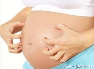 孕期痒症状,孕期皮肤痒一般会持续多久
