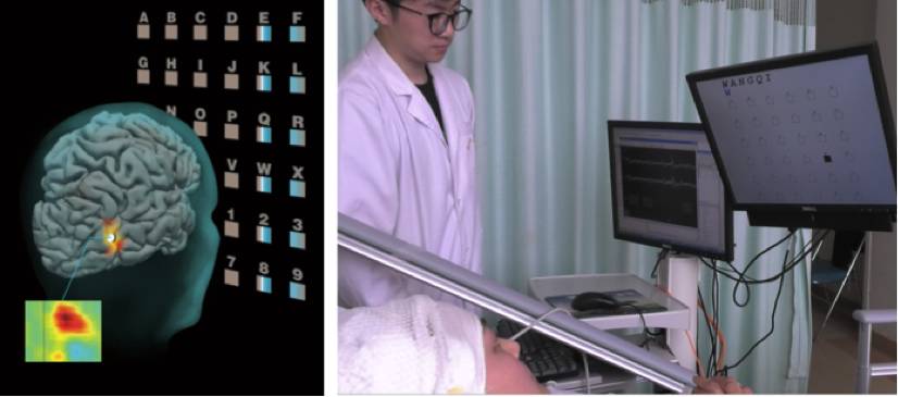 人类脑机接口进展历程,霍金脑机接口