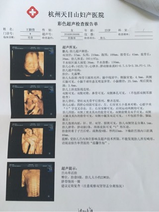 四维终于顺利通过了3次,四维顺利通过但是胎动还是不明显