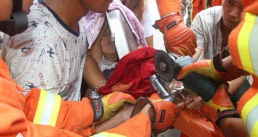 2岁男童拇指被绞断家长切勿大意,新疆8岁男孩干活手臂被绞断