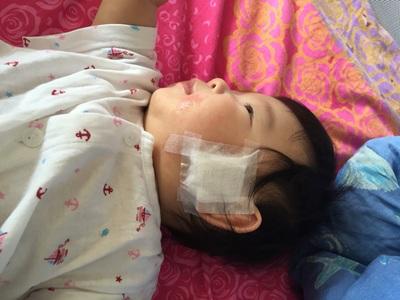 外耳道湿疹的中医治疗方法,外耳道湿疹小妙招