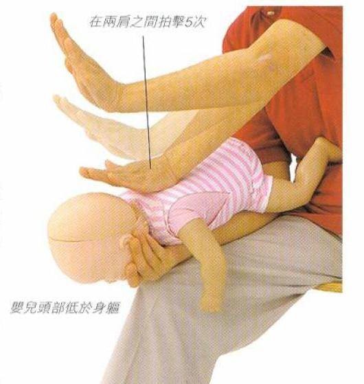 异物呛咳处理,异物卡喉的急救方法幼儿