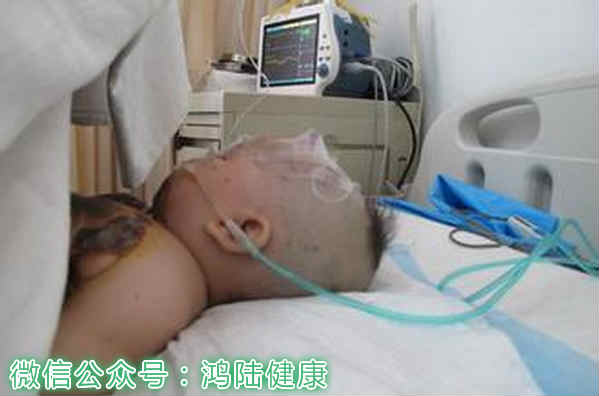 从烧伤烫伤中，凤凰涅槃，浴火重生