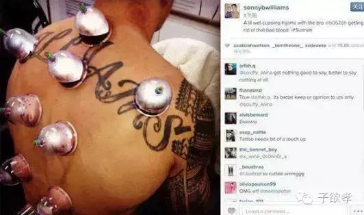 里约奥运会开幕式点燃火炬,里约奥运会拔火罐