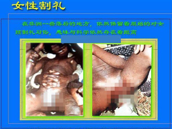 畸形矫正有后遗症吗,畸形矫正风险大吗