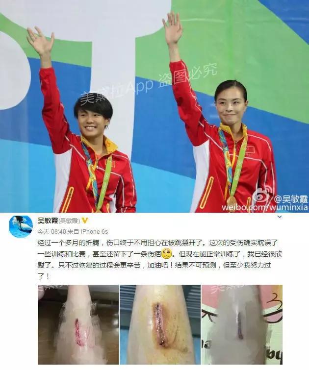 吴敏霞带伤训练视频,吴敏霞年轻的时候长啥样