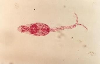 治疗黑唇纹超级有效的方法,怎么治疗黑嘴唇