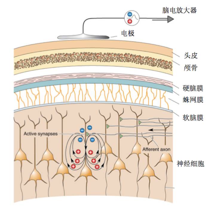 人类脑机接口进展历程,霍金脑机接口