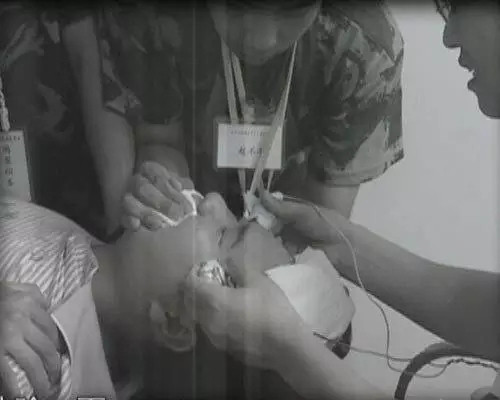 小孩被电击了要治疗吗,电击是对人体的什么伤害