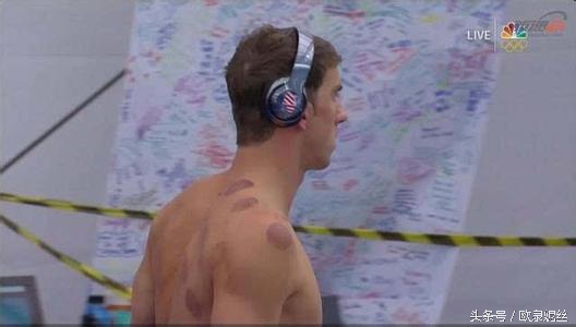 拔罐疗法的总结,拔罐疗法的适应症及关注事项