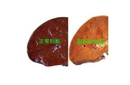 嘉善县人民医院肝胆科专家,上海周浦医院肝胆外科专家