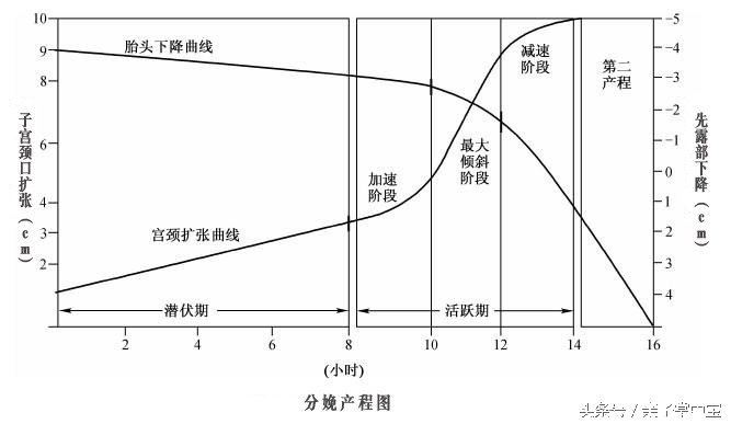 产妇关注了！分娩时生的太快，对新生儿有害！