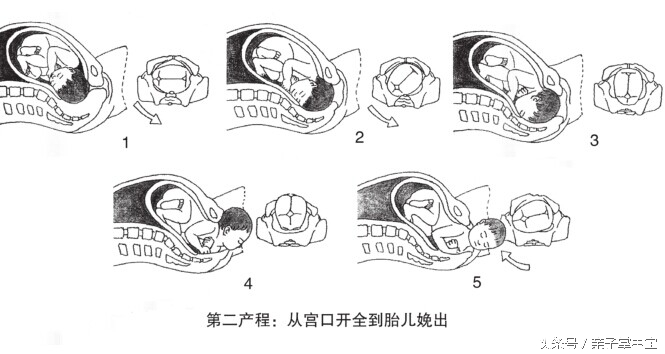 产妇关注了！分娩时生的太快，对新生儿有害！