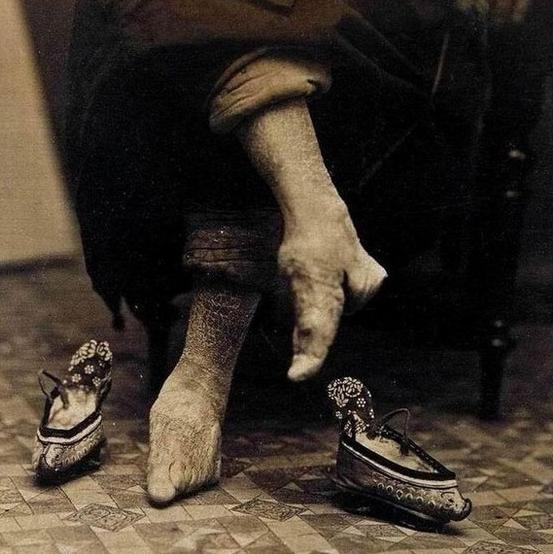 中国古代妇女缠足是什么意思,古代女性缠足是怎么来的