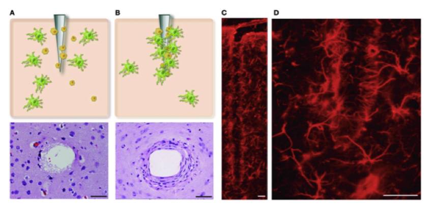 人类脑机接口进展历程,霍金脑机接口