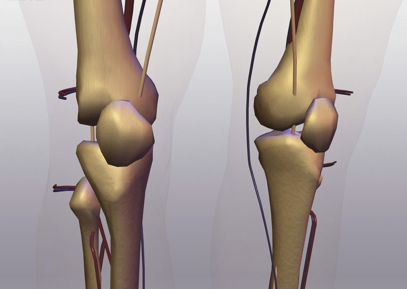 软骨病使用软骨素好使吗,软骨素对软骨好吗